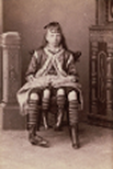 Myrtle Corbin, ein Mädchen mit vier Beinen sitzt auf
einem Stuhl. Bild in Sepia.